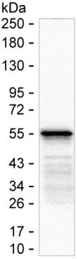 SARS-CoV-2 Nucleocapsid Protein